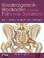 Iliosakralgelenk-Blockaden und das Piriformis-Syndrom