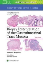 Biopsy Interpretation of the Gastrointestinal Tract Mucosa: Volume 2: Neoplastic