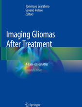 Imaging Gliomas After Treatment
