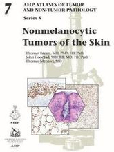 Nonmelanocytic Tumors of the Skin