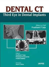 Dental CT Third Eye in Dental Implants
