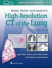 Webb, Mller and Naidich's High-Resolution CT of the Lung