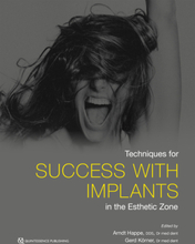 Techniques for Success With Implants in the Esthetic Zone