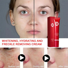 Retinol Whitening Face Cream Remove Wrinkle Freckle Shrink Anti-acne Removal Fade Treatment Fine Pores Skin Lines Creams Ca E7L4