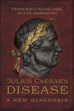 Julius Caesar's Disease – E-bok – Laddas ner