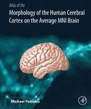 Atlas of the Morphology of the Human Cerebral Cortex on the Average MNI Brain