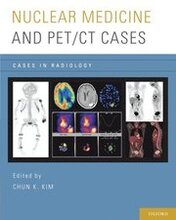 Nuclear Medicine and PET/CT Cases