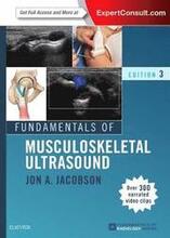 Fundamentals of Musculoskeletal Ultrasound
