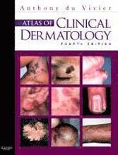 Atlas of Clinical Dermatology