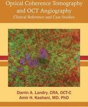 Optical Coherence Tomography and OCT Angiography: Clinical Reference and Case Studies
