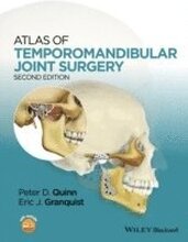 Atlas of Temporomandibular Joint Surgery