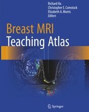 Breast MRI Teaching Atlas