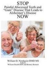 Stop Painful Abscessed Teeth and Gum Disease that Leads to Alzheimer's Now.