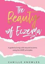 The Beauty of Eczema: A Guide To Living a Life Beyond Eczema Using The Hope Principles