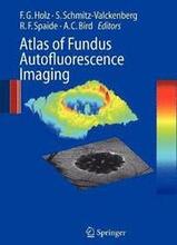 Atlas of Fundus Autofluorescence Imaging