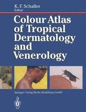 Colour Atlas of Tropical Dermatology and Venerology