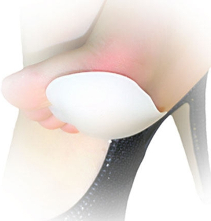 Anself 1 Paar Fußpflege Silikon Einlagen Vorfuß Schmerzlinderung Massage Gel Metatarsale Toe Unterstützung Pads
