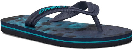 Profile Graphic Sandals Shoes Summer Shoes Flip Flops Blå O'neill*Betinget Tilbud