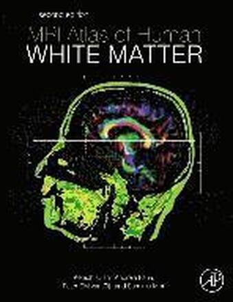 MRI Atlas of Human White Matter