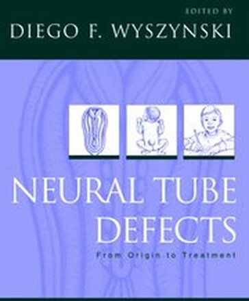 Neural Tube Defects