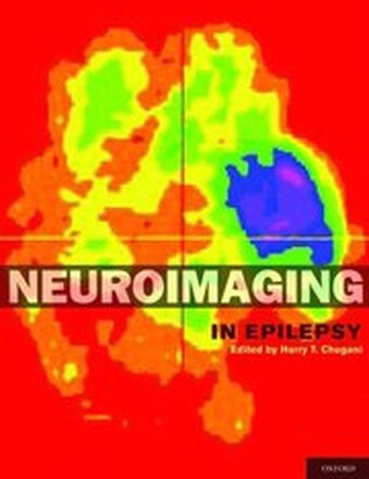 Neuroimaging in Epilepsy