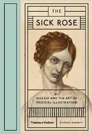 The Sick Rose