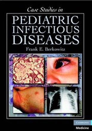 Case Studies in Pediatric Infectious Diseases
