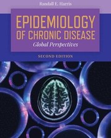 Epidemiology Of Chronic Disease: Global Perspectives