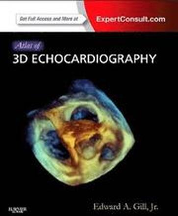 Atlas of 3D Echocardiography