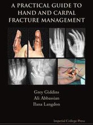 Practical Guide To Hand And Carpal Fracture Management, A