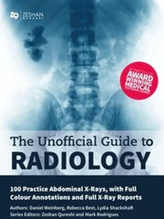 Unofficial Guide to Radiology: 100 Practice Abdominal X-Rays