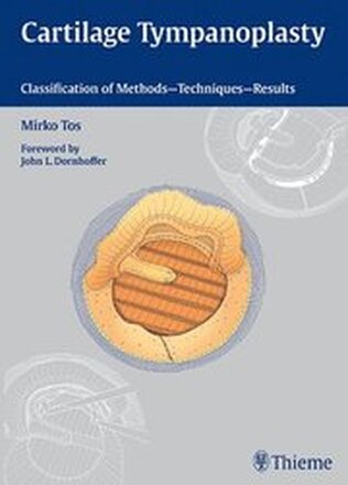 Cartilage Tympanoplasty: Classification of Methods -- Techniques -- Results