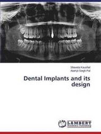 Dental Implants and Its Design