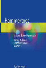 Hammertoes