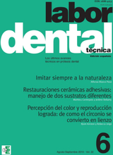 Labor Dental Técnica Vol.22 Ago-Sep 2019 nº6