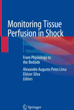 Monitoring Tissue Perfusion in Shock