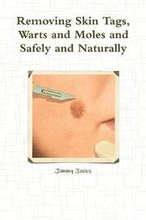 Removing Skin Tags, Warts and Moles and Safely and Naturally